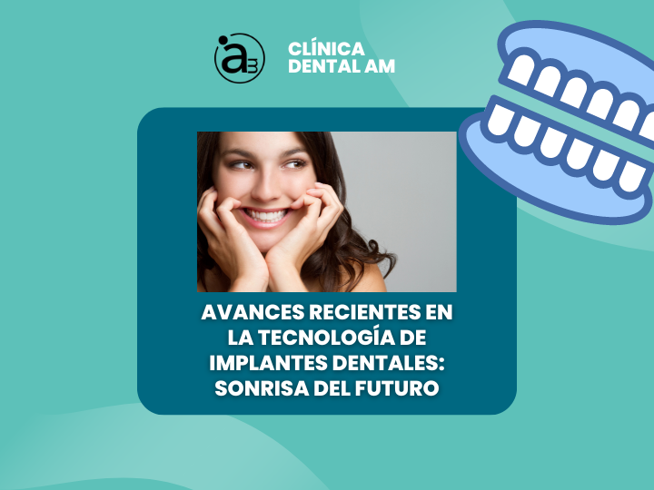 banner implantes dentales