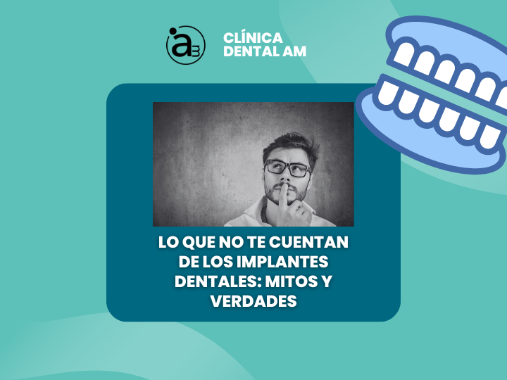 lo que no te cuentan de los implantes dentales